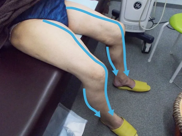 エコーゼリーをつける部分の説明