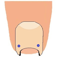 ①爪床に接していない所で爪に穴をあけます。